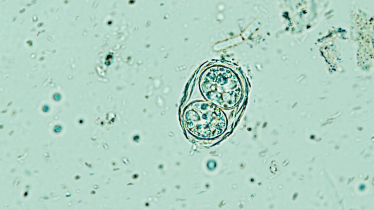 Toxoplasma gondii