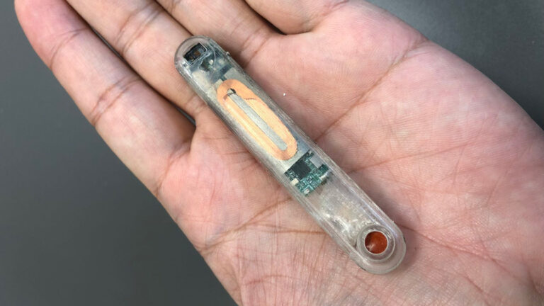 Overdose Response implantable